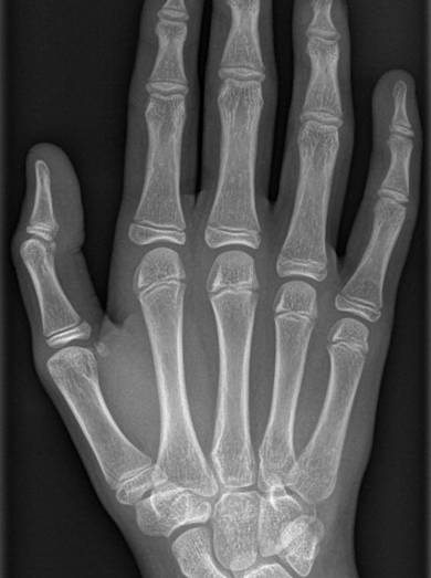 X hand.jpg
